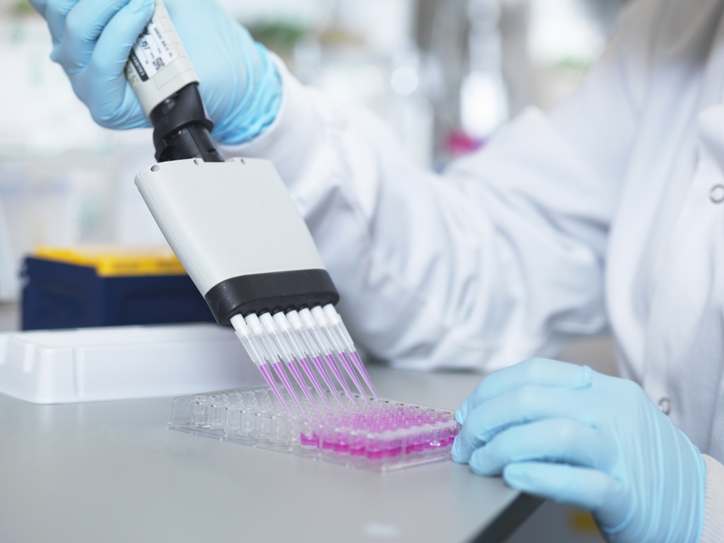   AGP ELISA Kit   